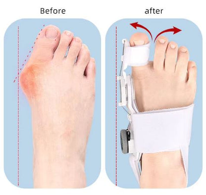 Ultimate Bunion Toe Corrector